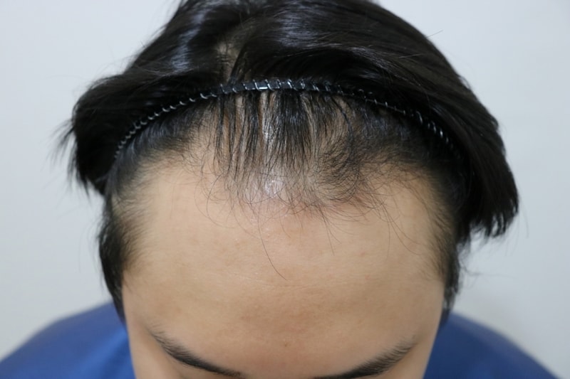 mo before2.jpg