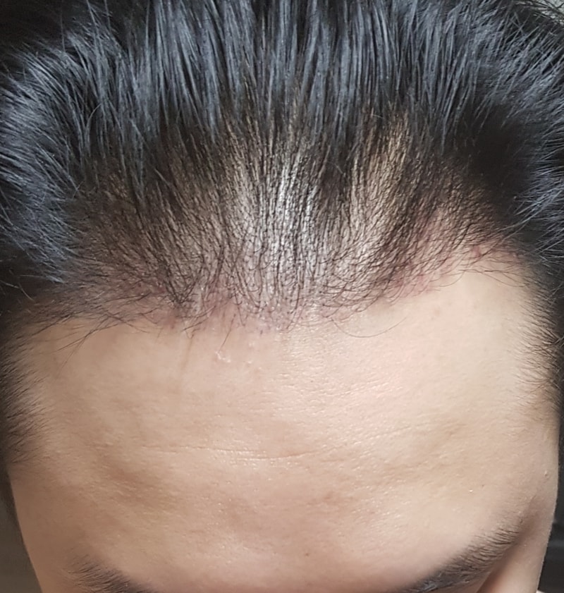 이제 140일차(4개월 조금 넘음) 되어가는데 걱정이 많이 되네요..