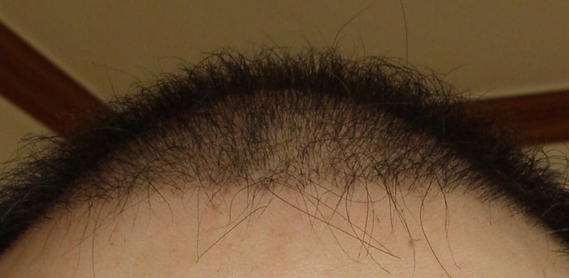 hairline.JPG