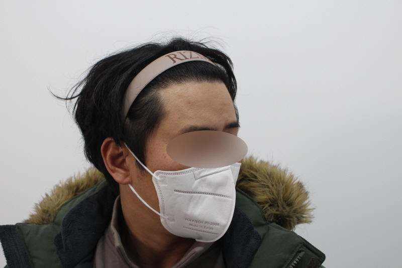 [크기변환]수술후 8개월차 측면s.jpg