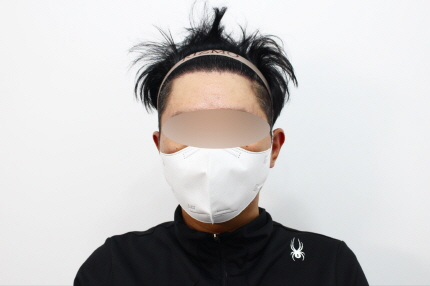[크기변환]수술후 9개월차dd.jpg