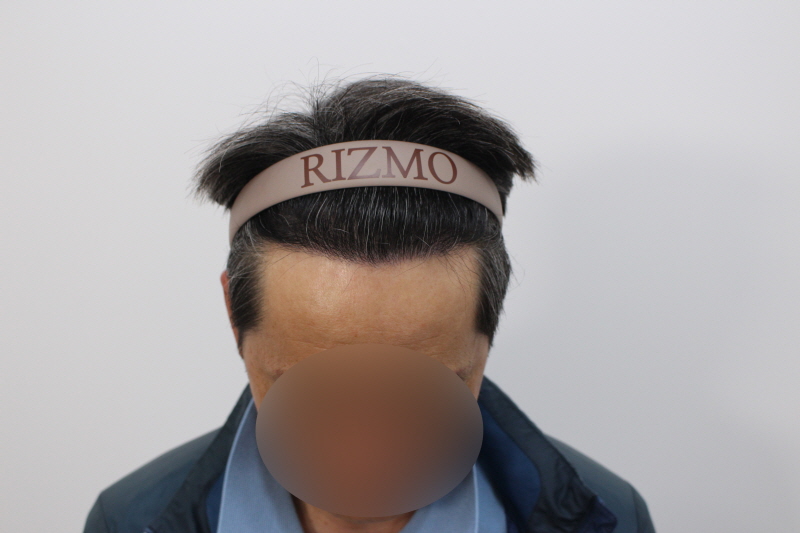 수술후.jpg