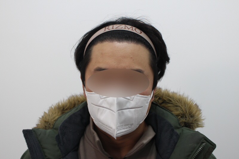 [크기변환]수술후 8개월차dd.jpg