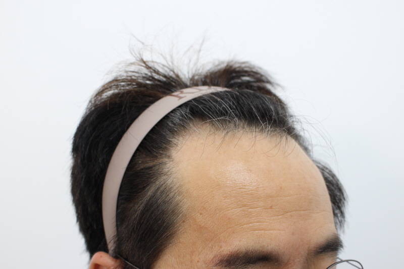 수술전1.jpg