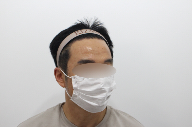 2[크기변환]수술후 240일차 2f.jpg