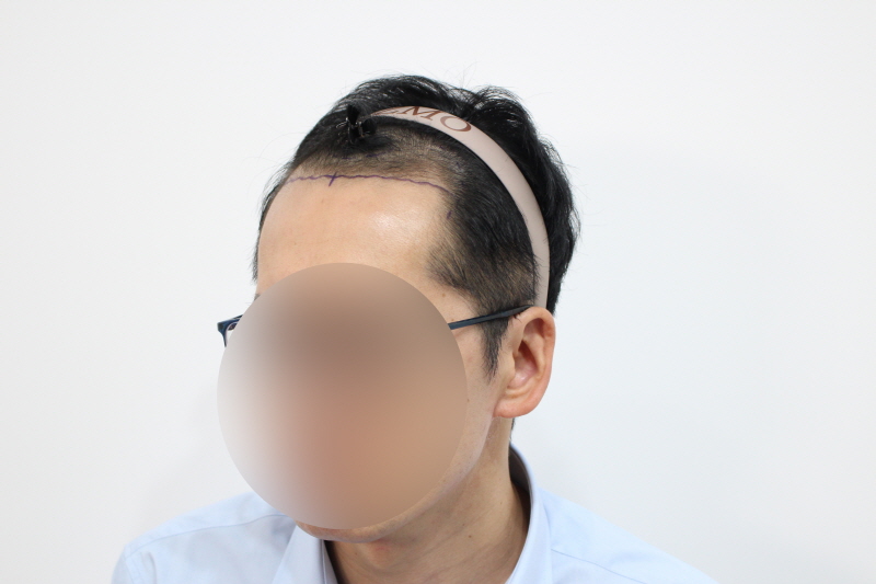 수술전 2.jpg