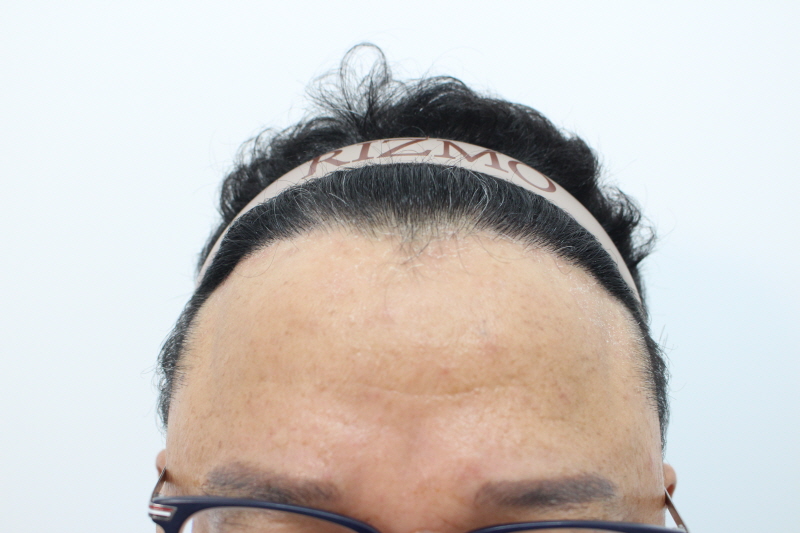 [크기변환]8개월차-정면.jpg
