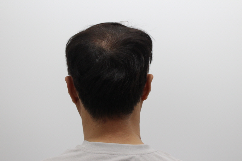 2[크기변환]수술후 240일차.jpg