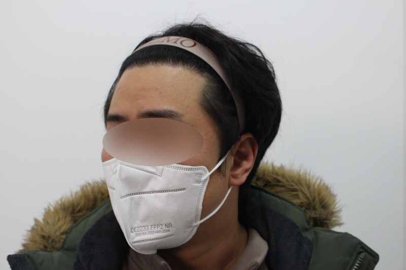 [크기변환]수술후 8개월차 측면1d.jpg