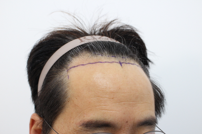 디자인후.jpg