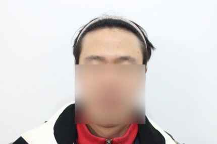 [크기변환]1년차 눈썹나오게 가려주세요s.jpg