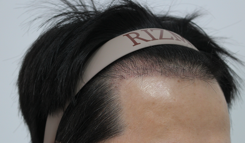 20220321_194847.png