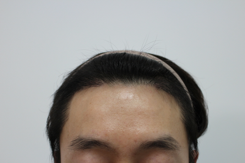 [크기변환]4개월후3.jpg