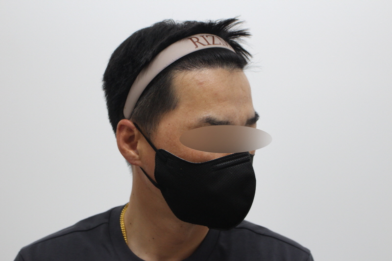 2[크기변환]부산 리즈모 옆헤어라인 240일차d.jpg