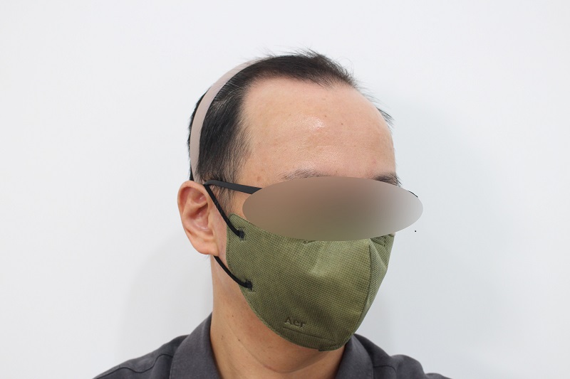 11. 수술전.jpg