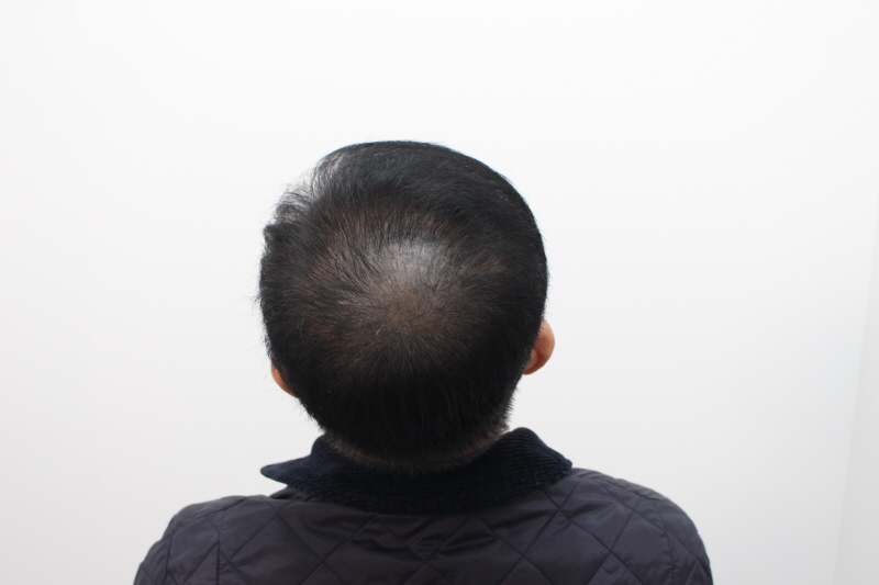 [크기변환]1년후 1.jpg