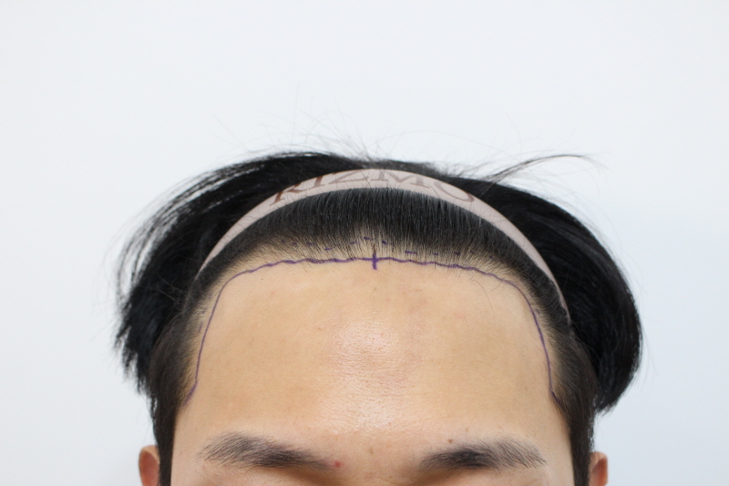 5. 디자인후.jpg