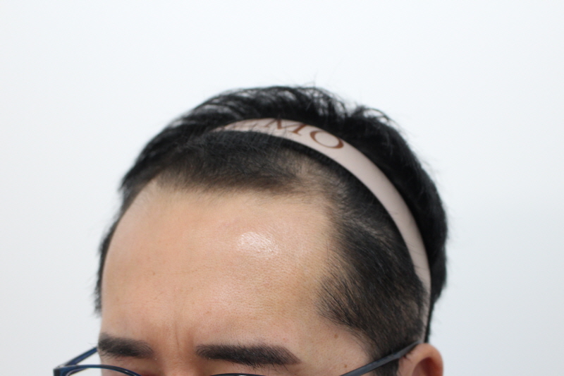 수술전.jpg