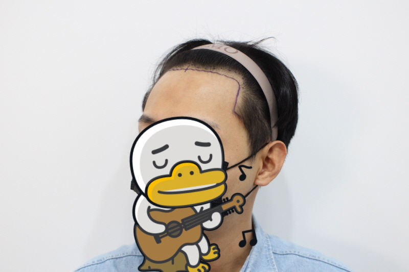 7. 수술전.jpg