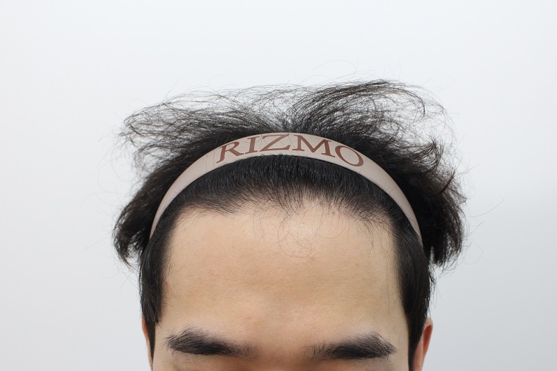수술전 2.jpg