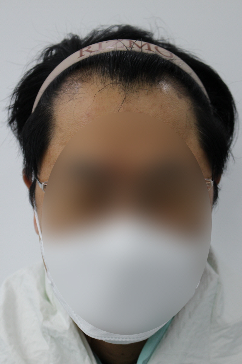 [크기변환]블러처리.jpg