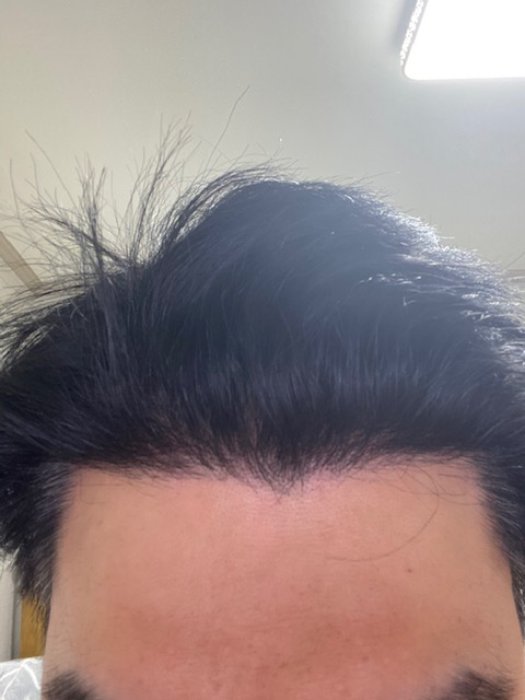 모재성 성형외과 354일차 입니다