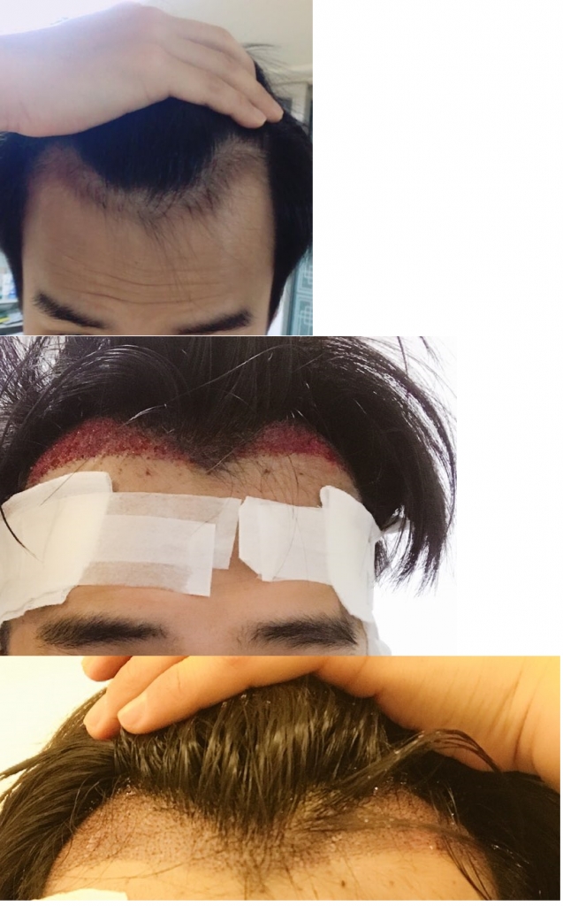 fffkfk.png