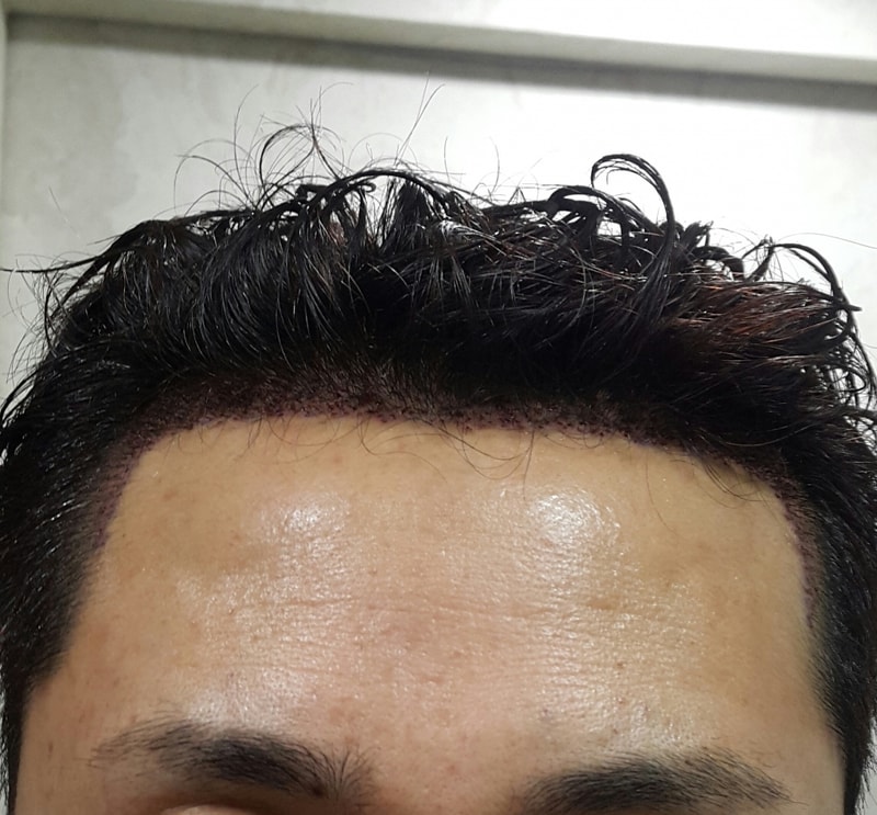 20170120_202309-1.jpg
