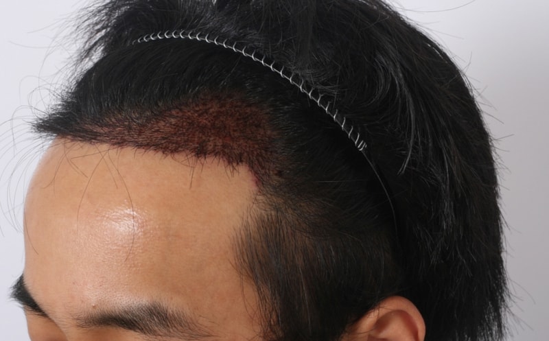 4 수술다음날 (2).jpg