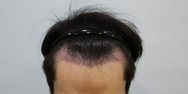 수술후 10일 (2).JPG