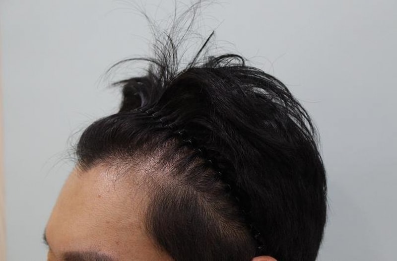 수술전2.JPG
