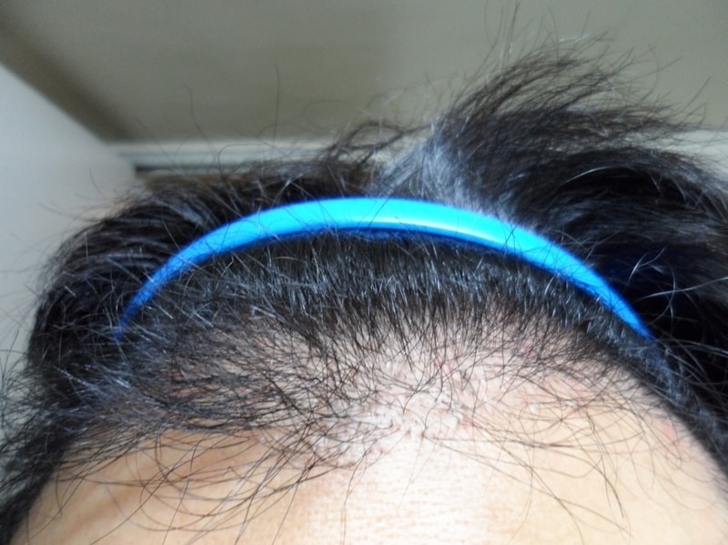 크기변환_머리띠 정면2.jpg