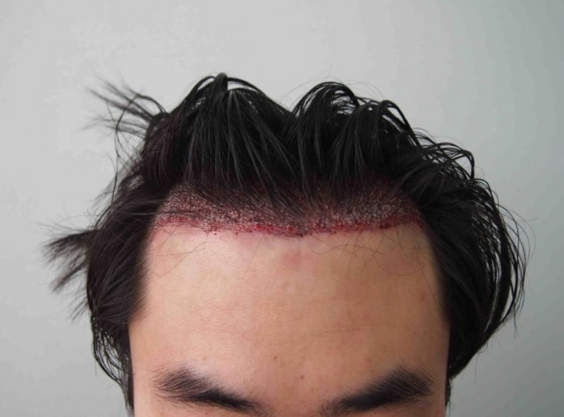 크기변환_수술후 1.JPG
