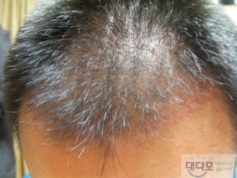 수술2.jpg