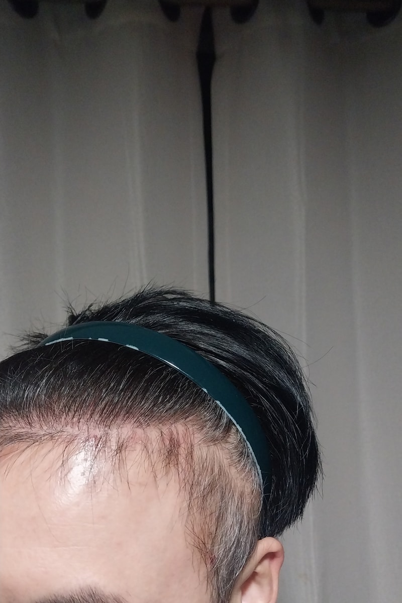 20251206_231532.jpg