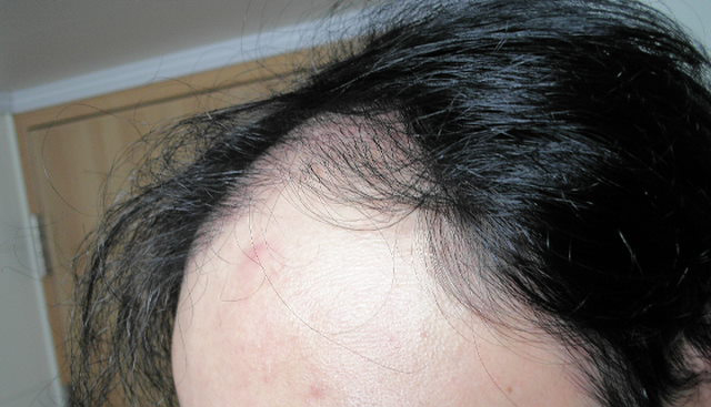before (11).JPG