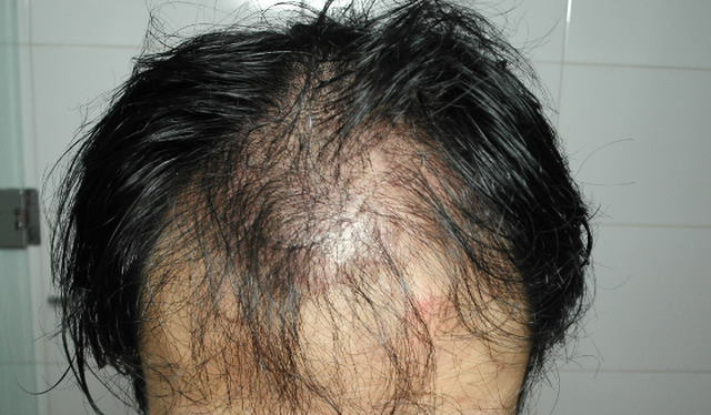 before (3).JPG
