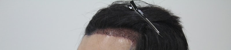샴푸후3.JPG