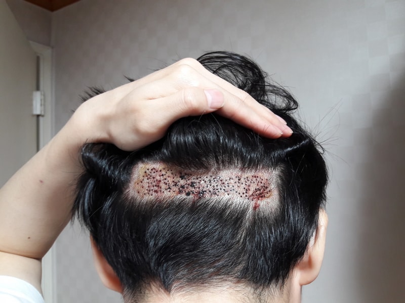 뒤1.jpg