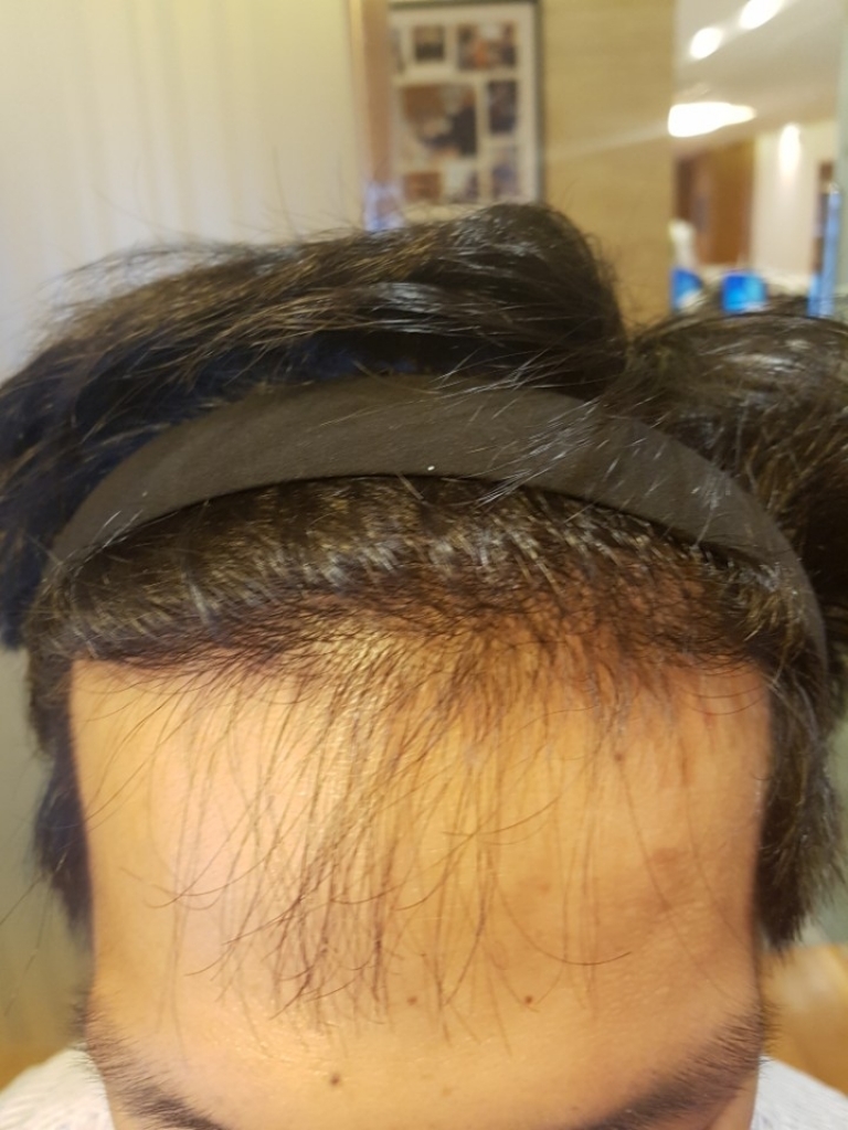 KakaoTalk_20170608_103531604.jpg