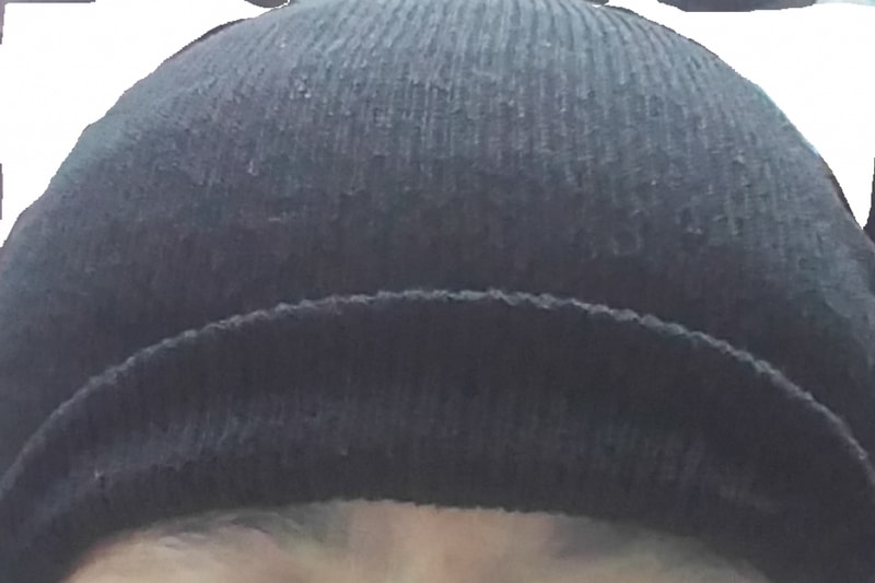 수술받고왔습니다. 오늘은 수술받고왔다는 간단한 인사부터. ㅎㅎ