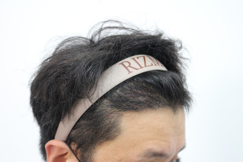4개월후 오른쪽.jpg