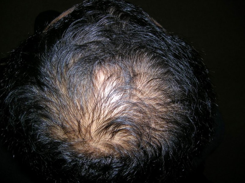 2.top & crown.jpg