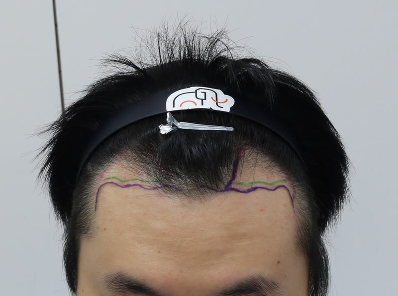4개월차 후기입니다.