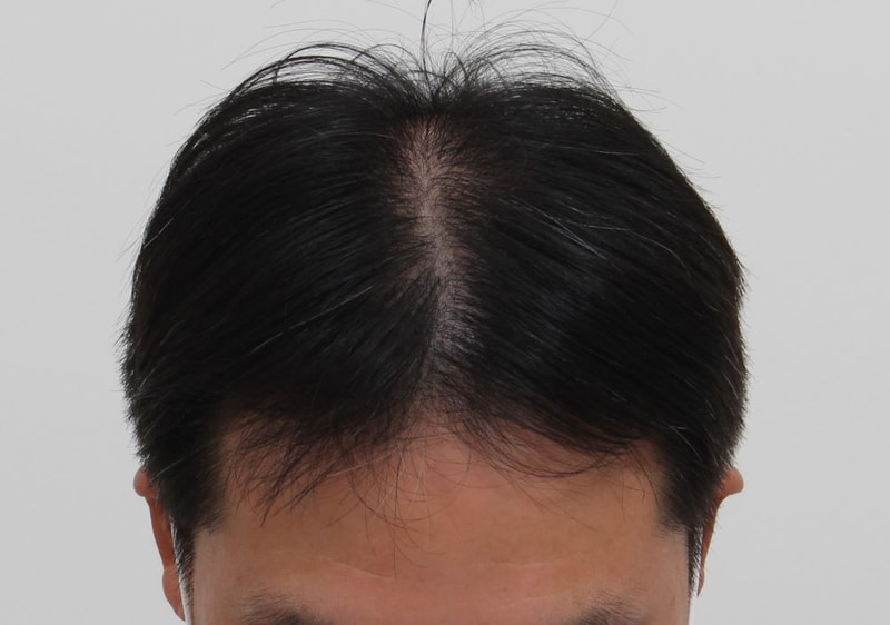 04.수술9개월.JPG