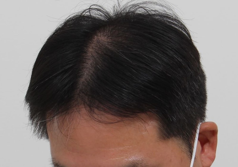 08.9개월차.JPG
