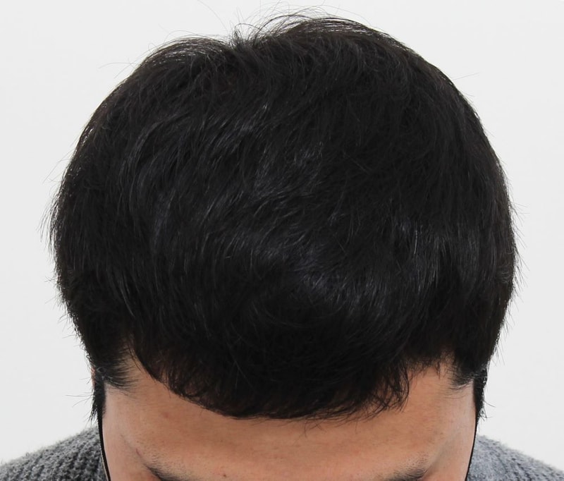 02.수술후.JPG