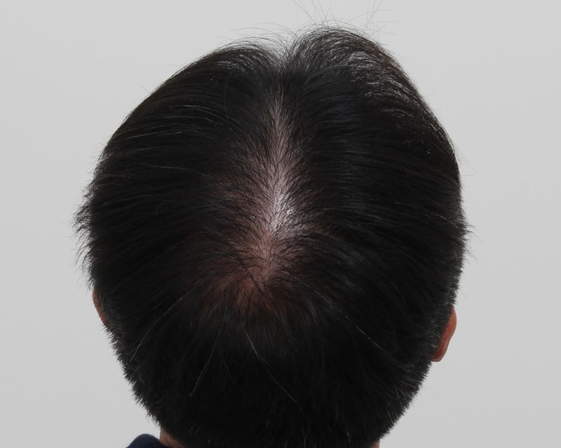 02.수술9개월.JPG