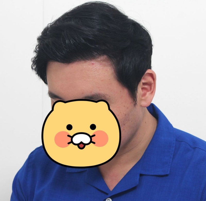 06.수술10달.jpg