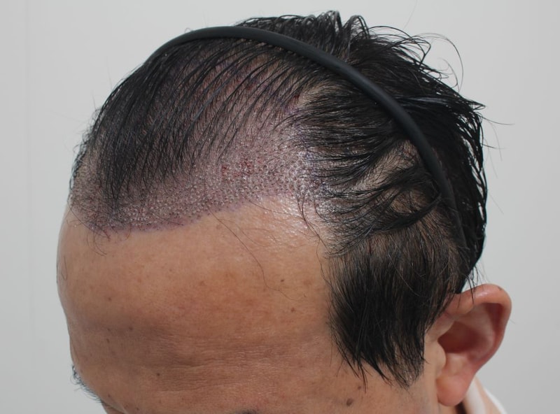 05.수술당일.JPG